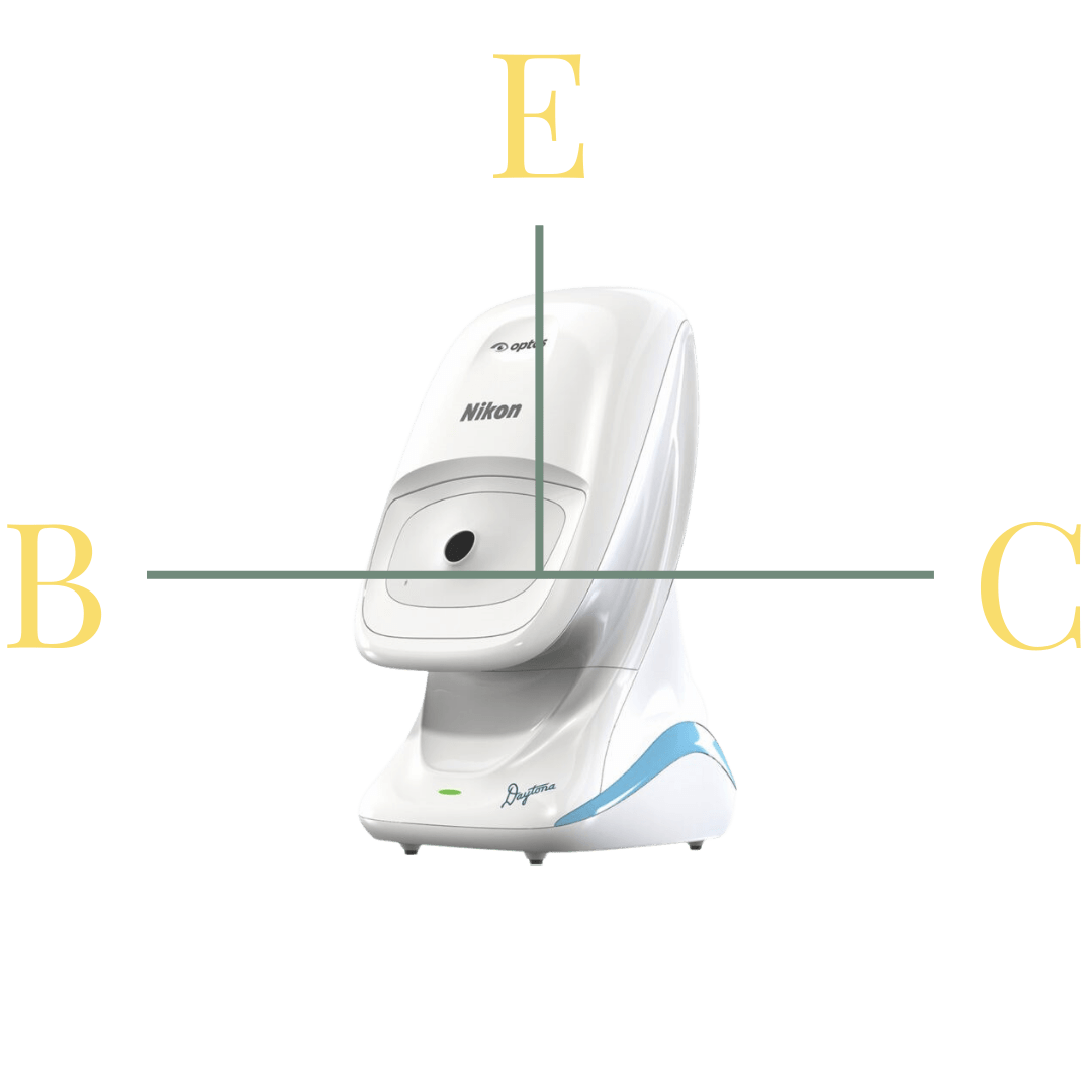 the-advanced-eye-exam-at-blackheath-eyecare-opticians-greenwich-london